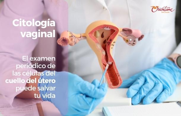 Citología vaginal