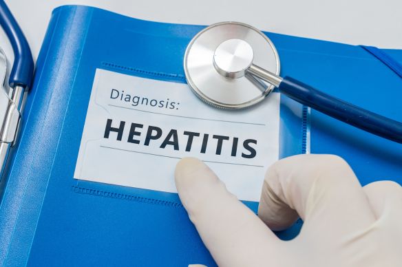 Hepatitis C: Síntomas, causas y tratamiento